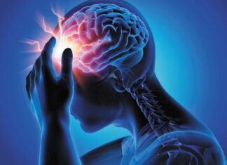 Headaches Illustration of an electric storm inside a human brain