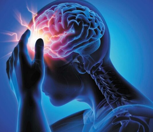 Headaches Illustration of an electric storm inside a human brain