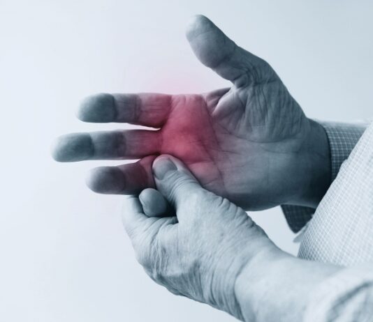 Arthritis Pain Close up of an elderly man's right hand with red color where joint pain occurs